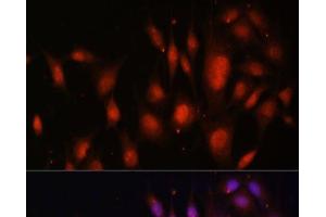 Immunofluorescence analysis of NIH/3T3 cells using TFEB Polyclonal Antibody at dilution of 1:100. (TFEB 抗体)