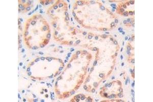 IHC-P analysis of Human Tissue, with DAB staining. (Talin 抗体  (AA 975-1181))
