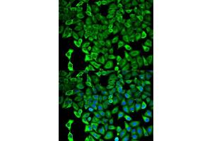 Immunofluorescence (IF) image for anti-Proteasome (Prosome, Macropain) 26S Subunit, Non-ATPase, 2 (PSMD2) (AA 1-260) antibody (ABIN3015813)