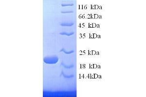 Interferon gamma (IFNG) (AA 24-166) protein (His tag) (Interferon gamma Protein (IFNG) (AA 24-166) (His tag))