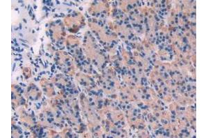 Immunohistochemistry (Paraffin-embedded Sections) (IHC (p)) image for anti-Calpain 1, Large Subunit (CAPNL1) (AA 387-694) antibody (ABIN2901959)