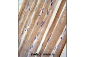 INB antibody (C-term) (ABIN654447 and ABIN2844181) immunohistochemistry analysis in formalin fixed and paraffin embedded human skeletal muscle followed by peroxidase conjugation of the secondary antibody and DAB staining. (INPP5B 抗体  (C-Term))