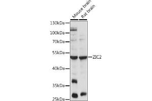 Western blot analysis of extracts of various cell lines, using ZIC2 antibody (ABIN7271432) at 1:1000 dilution. (ZIC2 抗体  (AA 1-220))