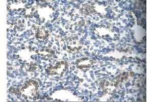 Rabbit Anti-SUV39H1 Antibody       Paraffin Embedded Tissue:  Human alveolar cell   Cellular Data:  Epithelial cells of renal tubule  Antibody Concentration:   4. (SUV39H1 抗体  (C-Term))