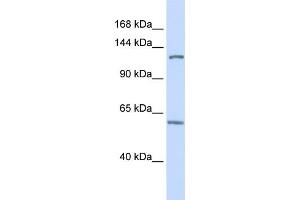 WB Suggested Anti-PHF12 Antibody Titration:  0. (PHF12 抗体  (C-Term))