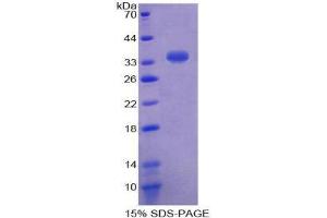 SDS-PAGE (SDS) image for Sulfotransferase Family, Cytosolic, 1A, Phenol-Preferring, Member 1 (SULT1A1) (AA 3-285) protein (His tag) (ABIN2126273)