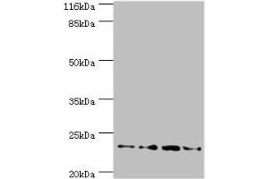 Western blot All lanes: Fxn antibody at 2 μg/mL Lane 1: HepG2 whole cell lysate Lane 2: Hela whole cell lysate Lane 3: Mouse brain tissue Lane 4: Jurkat whole cell lysate Secondary Goat polyclonal to rabbit IgG at 1/10000 dilution Predicted band size: 23 kDa Observed band size: 23 kDa (Frataxin 抗体  (AA 78-207))