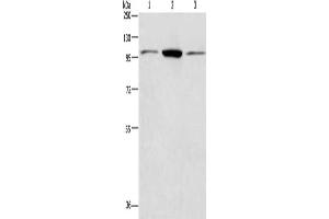 Gel: 8 % SDS-PAGE, Lysate: 40 μg, Lane 1-3: Hela cells, Jurkat cells, NIH/3T3 cells, Primary antibody: ABIN7128400(ANAPC2 Antibody) at dilution 1/200, Secondary antibody: Goat anti rabbit IgG at 1/8000 dilution, Exposure time: 40 seconds (ANAPC2 抗体)