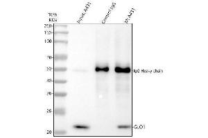 Immunoprecipitating GLO1 in A431 whole cell lysate.
