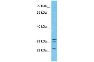 Host:  Rabbit  Target Name:  PGRC2  Sample Type:  Fetal Lung lysates  Antibody Dilution:  1ug/ml (PGRMC1 抗体  (C-Term))