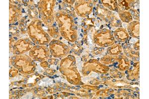 ABIN6257018 and ABIN6274200 at 1/100 staining Rat kidney tissue by IHC-P.