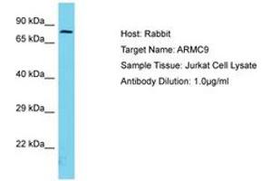 Image no. 1 for anti-Armadillo Repeat Containing 9 (ARMC9) (AA 90-139) antibody (ABIN6750691) (ARMC9 抗体  (AA 90-139))