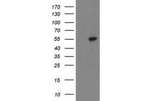 Western Blotting (WB) image for anti-ATPase, H+ Transporting, Lysosomal 56/58kDa, V1 Subunit B1 (ATP6V1B1) antibody (ABIN1496774) (ATP6V1B1 抗体)