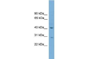 WB Suggested Anti-HAPLN4 Antibody Titration:  0. (HAPLN4 抗体  (C-Term))