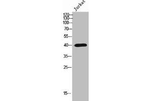 Western Blot analysis of Jurkat cells using Olfactory receptor 2AP1 Polyclonal Antibody (OR2AP1 抗体  (C-Term))