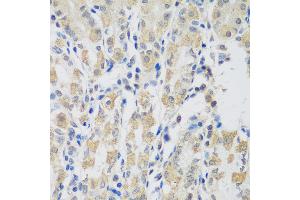 Immunohistochemistry of paraffin-embedded human stomach using VPS4A antibody at dilution of 1:100 (40x lens).