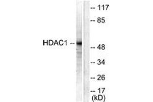 Western blot analysis of extracts from NIH-3T3 cells, using HDAC1 Antibody. (HDAC1 抗体  (AA 433-482))