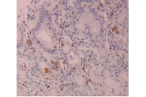 IHC-P analysis of Human Stomach Tissue, with DAB staining. (FLG2 抗体  (AA 1222-1368))
