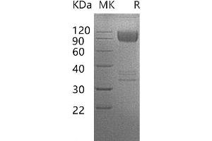 Western Blotting (WB) image for CD86 (CD86) protein (Fc Tag) (ABIN7320949) (CD86 Protein (CD86) (Fc Tag))