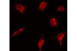 ABIN6274179 staining HeLa cells by IF/ICC. (ZNF18 抗体  (C-Term))
