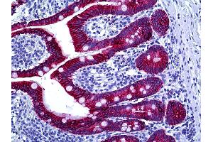 Anti-Cytokeratin Type II antibody IHC of human intestine. (Keratin Basic 抗体)