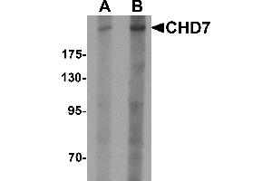 Western blot analysis of CHD7 in SK-N-SH cell lysate with CHD7 antibody at (A) 1 and (B) 2 µg/mL. (CHD7 抗体  (N-Term))