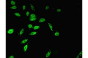 Immunofluorescent analysis of Hela cells using ABIN7173949 at dilution of 1:100 and Alexa Fluor 488-congugated AffiniPure Goat Anti-Rabbit IgG(H+L) (TWIST2 抗体  (AA 1-70))