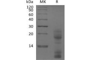 Western Blotting (WB) image for Thymic Stromal Lymphopoietin (TSLP) (Active) protein (His tag) (ABIN7319801) (Thymic Stromal Lymphopoietin Protein (TSLP) (His tag))