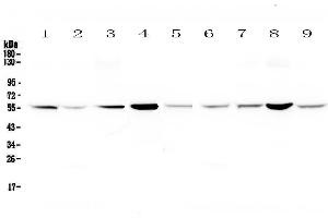 Western blot analysis of Glutathione Reductase using anti-Glutathione Reductase antibody . (Glutathione Reductase 抗体  (AA 256-522))