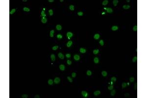 Immunofluorescence (IF) image for anti-Histone Cluster 1, H4a (HIST1H4A) (acLys91) antibody (ABIN7139206)