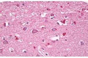 Image no. 2 for anti-Ras Homolog Family Member G (RHOG) (AA 112-161) antibody (ABIN6749774) (RHOG 抗体  (AA 112-161))