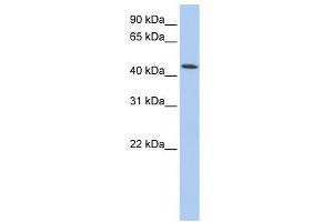 VPS4A antibody used at 1 ug/ml to detect target protein.