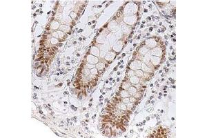 Immunohistochemistry (IHC) image for anti-Checkpoint Kinase 2 (CHEK2) antibody (ABIN487312) (CHEK2 抗体)