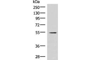 Western blot analysis of Human heart tissue lysate using IRX1 Polyclonal Antibody at dilution of 1:300 (IRX1 抗体)