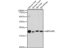 Western blot analysis of extracts of various cell lines, using NIPSN antibody (ABIN7265337) at 1:1000 dilution. (NIPSNAP1 抗体)