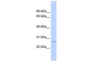 Image no. 1 for anti-Glutathione S-Transferase pi 1 (GSTP1) (AA 35-84) antibody (ABIN6743477) (GSTP1 抗体  (AA 35-84))