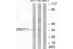 Western blot analysis of extracts from MCF-7 cells and HeLa cells, using OR2T11 antibody. (OR2T11 抗体  (Internal Region))