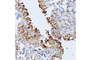 Immunohistochemistry (IHC) image for anti-Septin 4 (SEPT4) (AA 1-100) antibody (ABIN6147554)