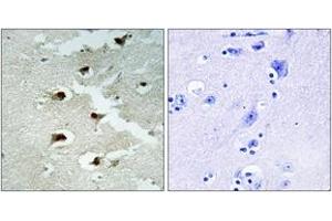 Immunohistochemistry analysis of paraffin-embedded human brain tissue, using CDCA4 Antibody. (CDCA4 抗体  (AA 121-170))