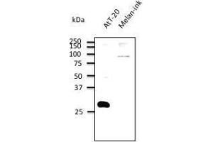 Anti. (RAB27B 抗体  (C-Term))