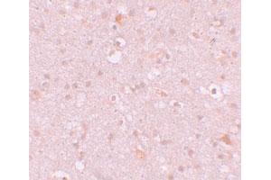 Immunohistochemical staining of human brain cells with CXXC4 polyclonal antibody  at 10 ug/mL. (CXXC4 抗体  (N-Term))