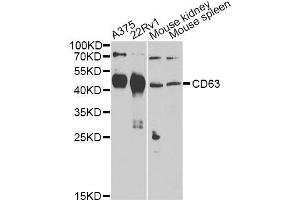 Western blot analysis of extracts of various cell lines, using CD63 Antibody (ABIN5974980) at 1/1000 dilution. (CD63 抗体)