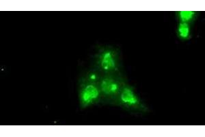 Image no. 2 for anti-Neurotrophic tyrosine Kinase, Receptor, Type 3 (NTRK3) antibody (ABIN1499841) (NTRK3 抗体)