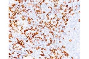 IHC testing of human tonsil (20X) stained with CD8a antibody (C8/468). (CD8 alpha 抗体)