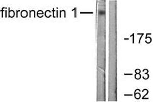 Western blot analysis of extracts from HeLa cells, using Fibronectin 1 Antibody. (Fibronectin 1 抗体  (AA 2337-2386))