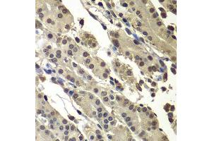 Immunohistochemistry (Paraffin-embedded Sections) (IHC (p)) image for anti-Activated RNA Polymerase II Transcriptional Coactivator p15 (SUB1) (AA 1-127) antibody (ABIN6148686)