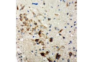 Anti-Hamartin antibody, IHC(P) IHC(P): Rat Brain Tissue (TSC1 抗体  (C-Term))