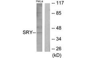 Western blot analysis of extracts from HeLa cells, using SRY Antibody. (SRY 抗体  (AA 51-100))