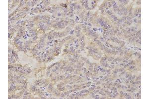 Immunohistochemistry (IHC) image for anti-Golgin A2 (GOLGA2) antibody (ABIN1876532) (Golgin A2 (GOLGA2) 抗体)