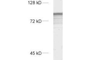 dilution: 1 : 1000, sample: rat brain homogenate (SYNPO 抗体  (Isoform 2))